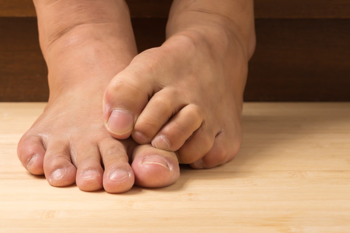 soulager naturellement la neuropathie des pieds