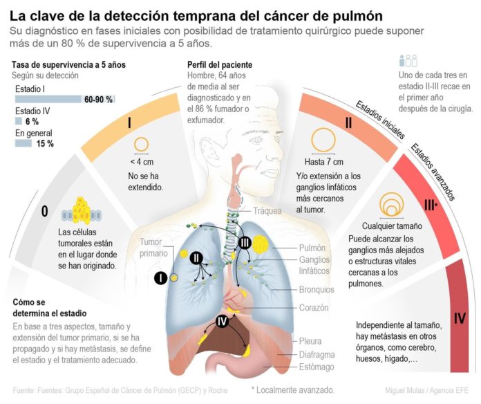 Infografía cáncer de pulmón