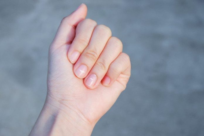 Quand l'apparence des ongles est un signe d'alerte de certaines maladies

