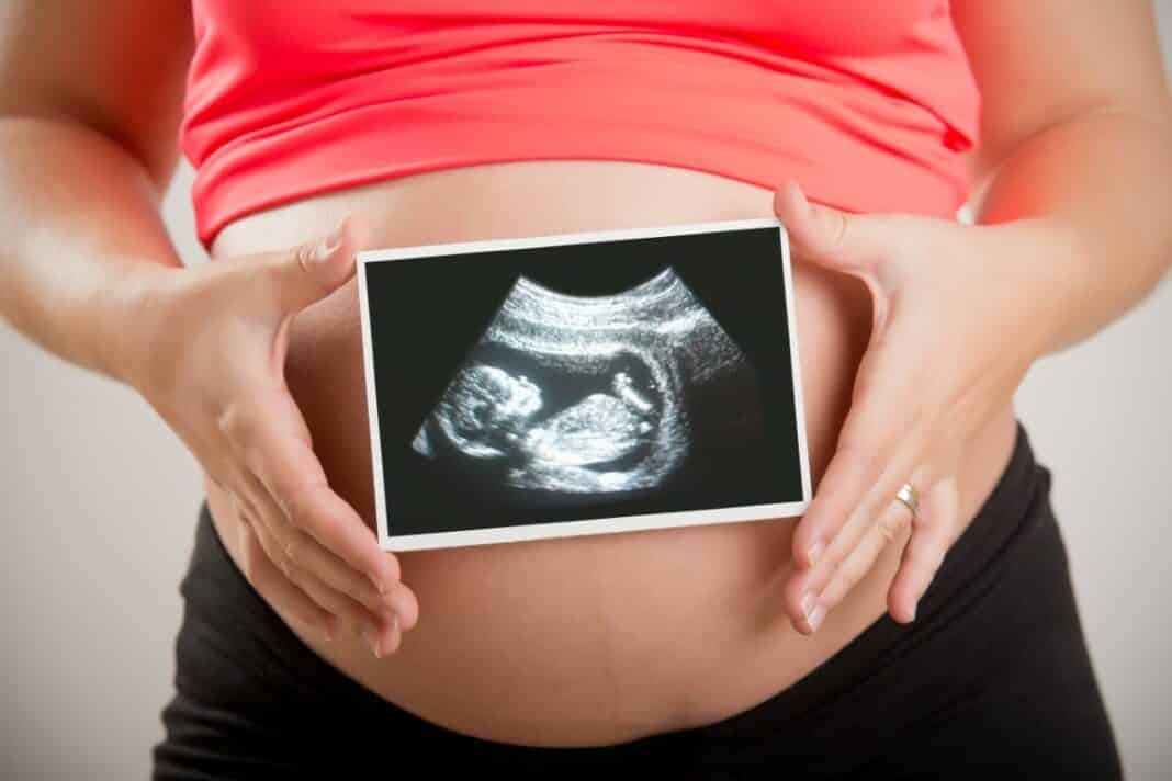 Femme enceinte tenant une échographie de son enfant
