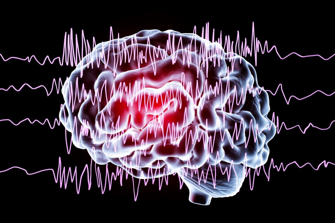 L'effet de l'épilepsie sur le cerveau