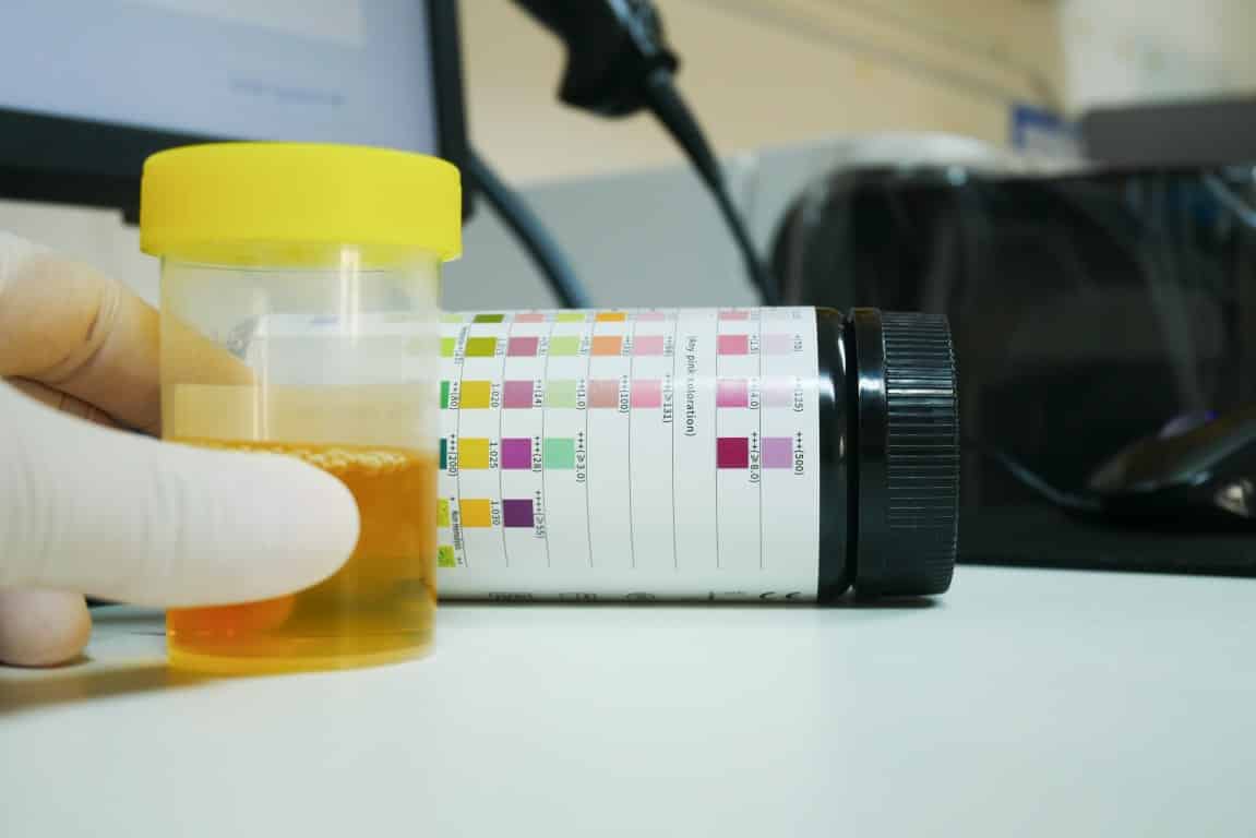 Une analyse d'urine