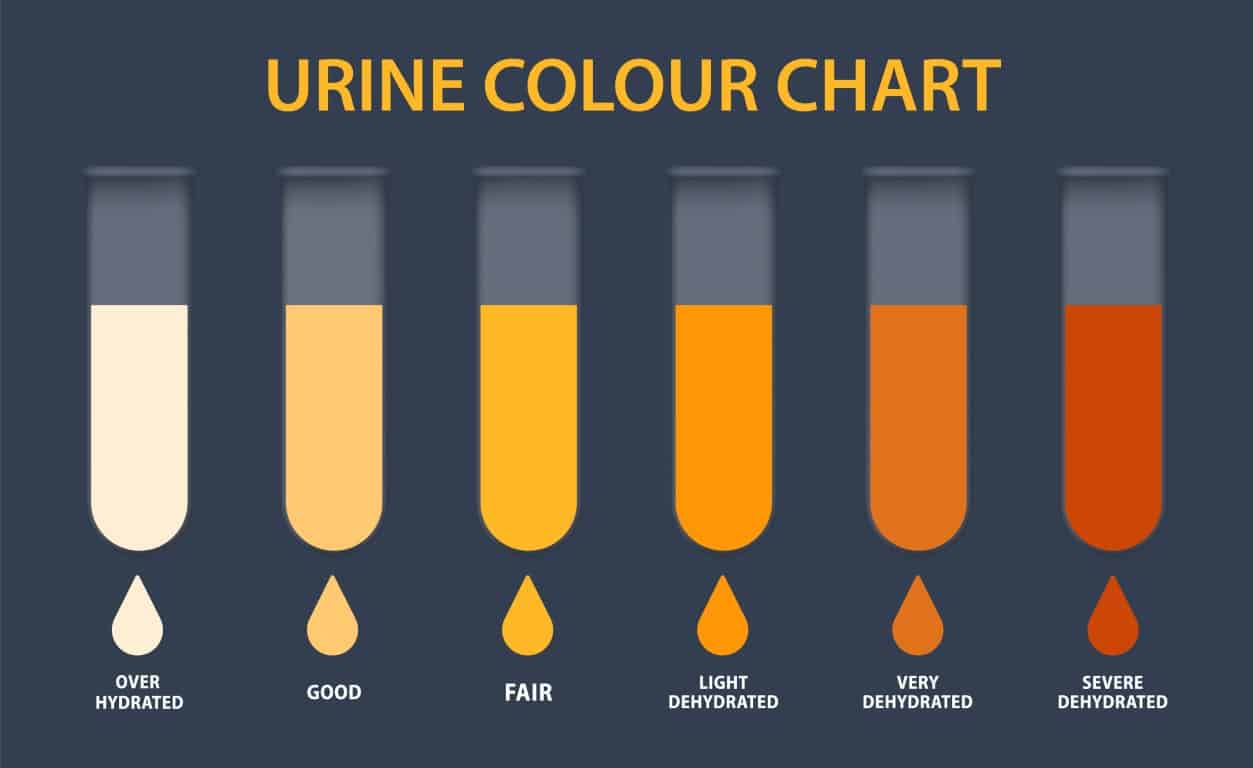 L'urine peut avoir plusieurs couleurs différentes