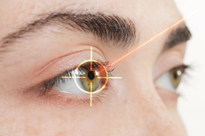 correction de la vision par laser